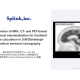 株式会社　Ｓｐｌｉｎｋ